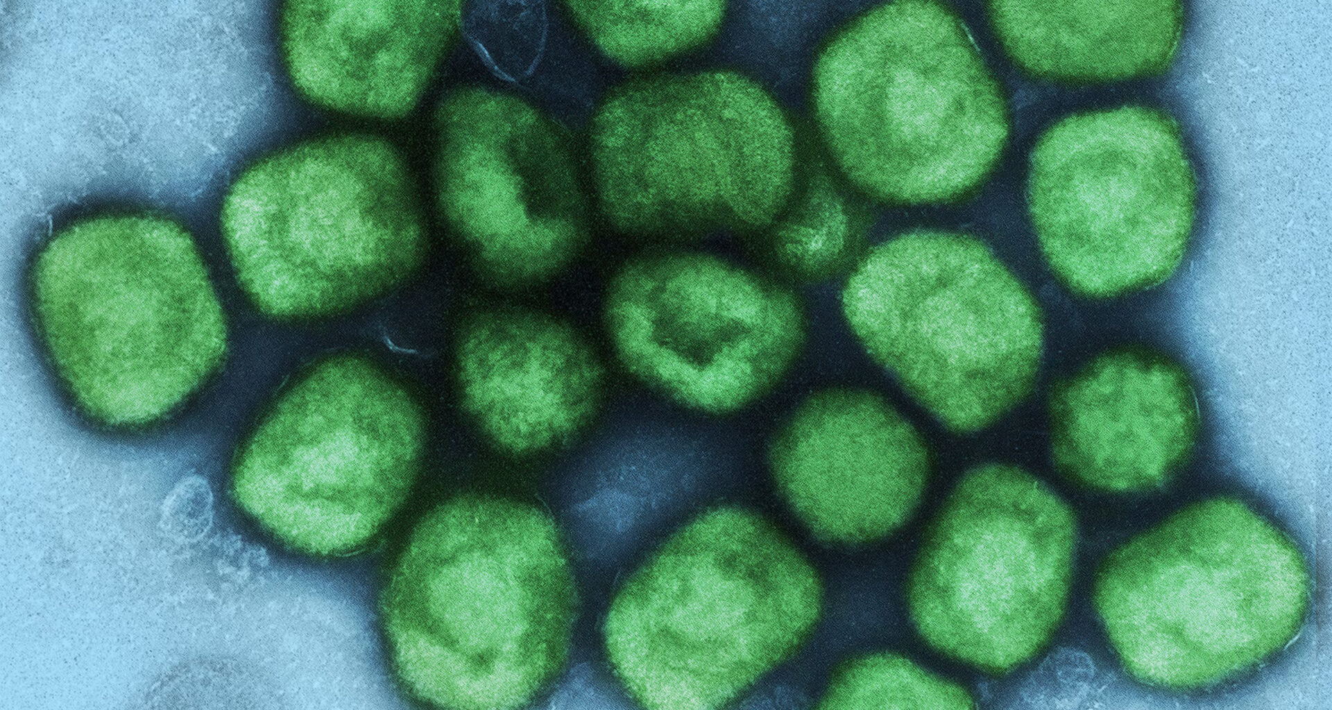 Affenpockenvirus